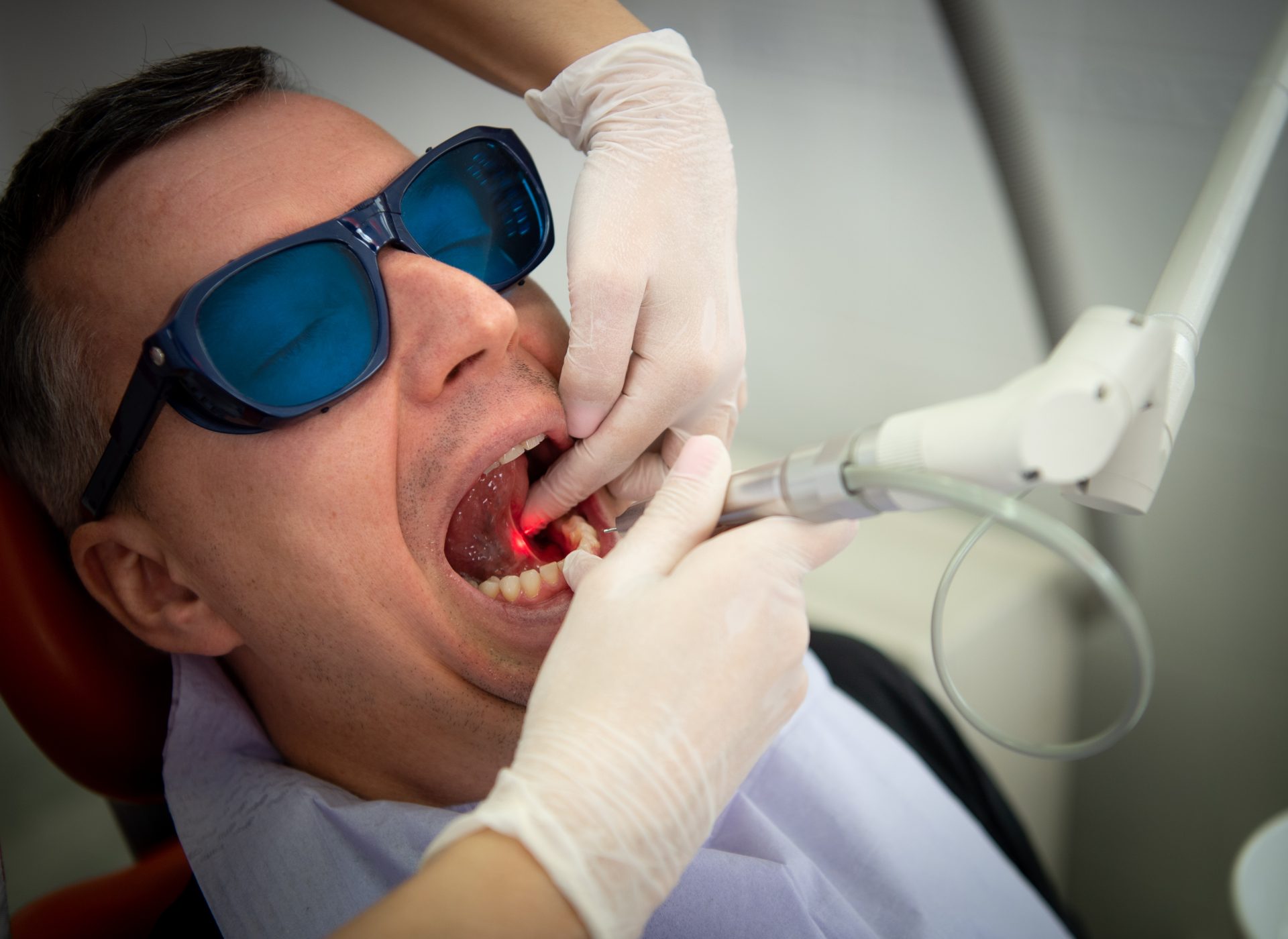 Podcięcie wędzidełka Wrocław