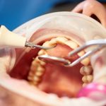 Mikrobiom jamy ustnej