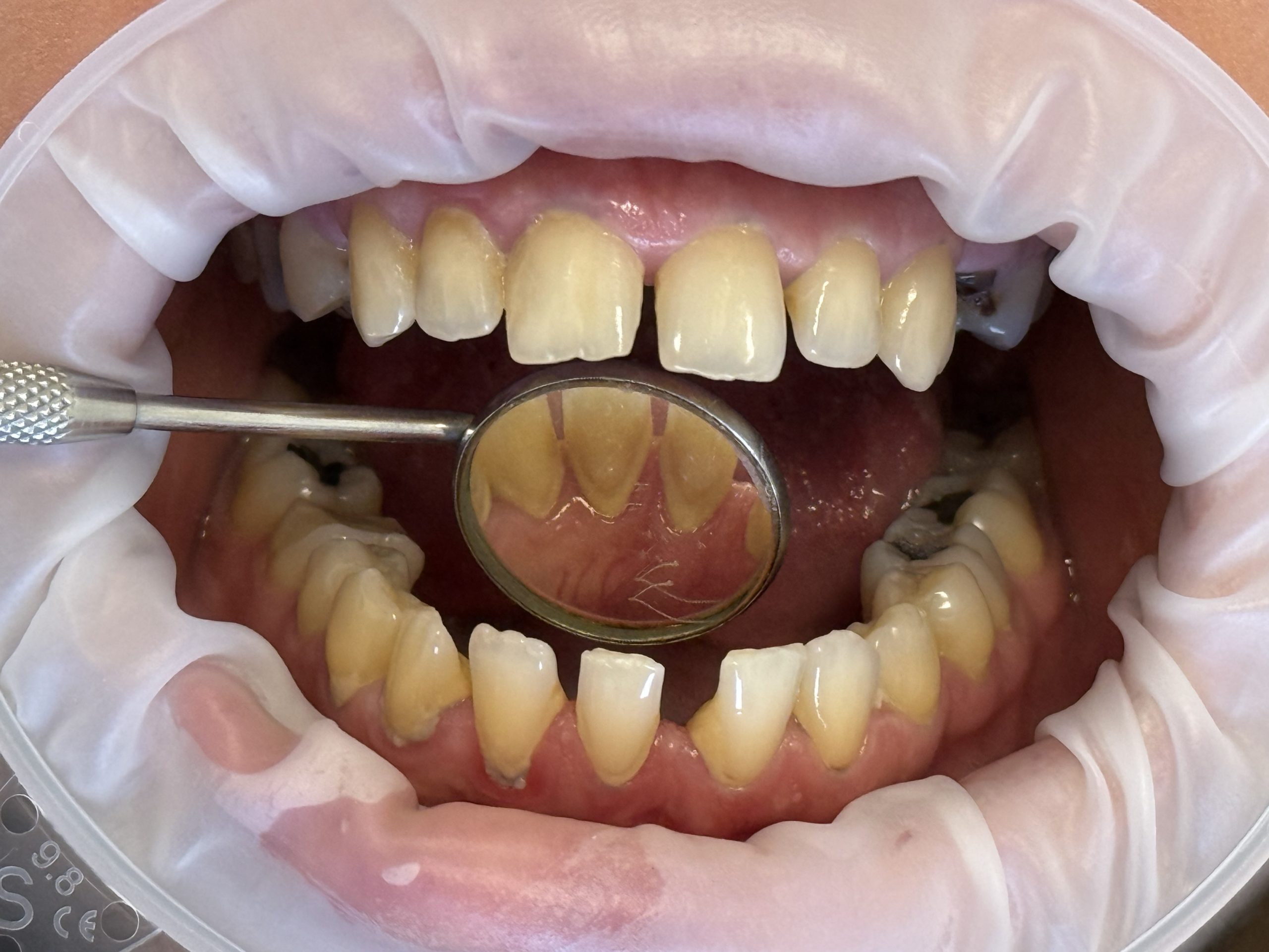 Before image
