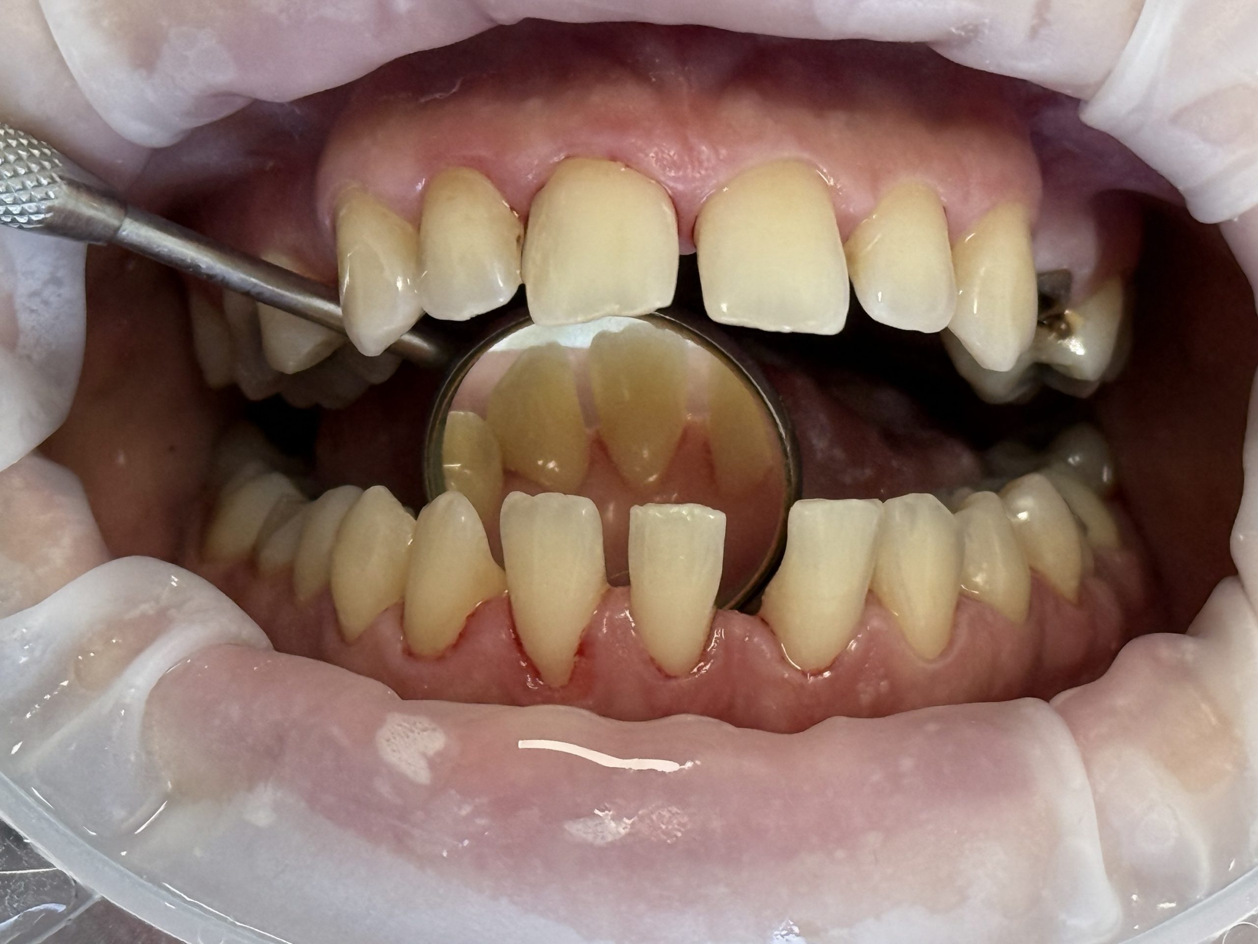 After image